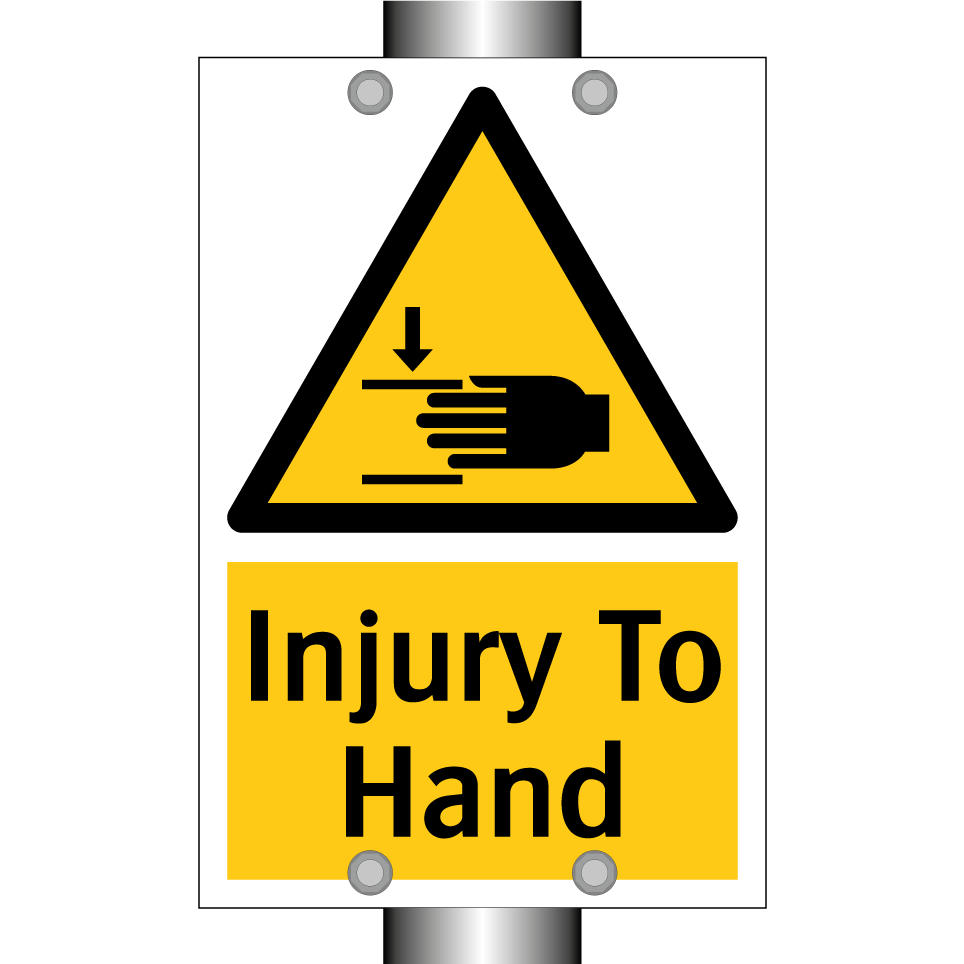 Injury To Hand